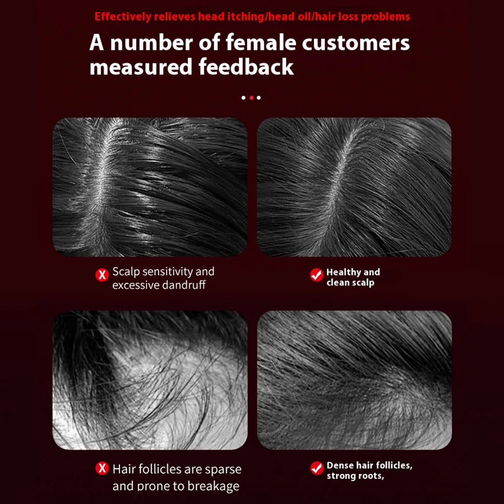 💆‍♀️ 3️⃣ SabbaVie™ Electric Hair & Scalp Massage Comb — Vibrating Infrared Comb