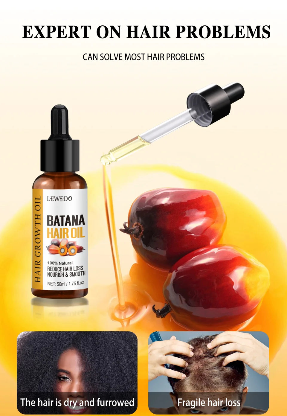 🌴 SabbaVie™ Pure Batana Hair Growth Oil — Nourish, Strengthen & Restore