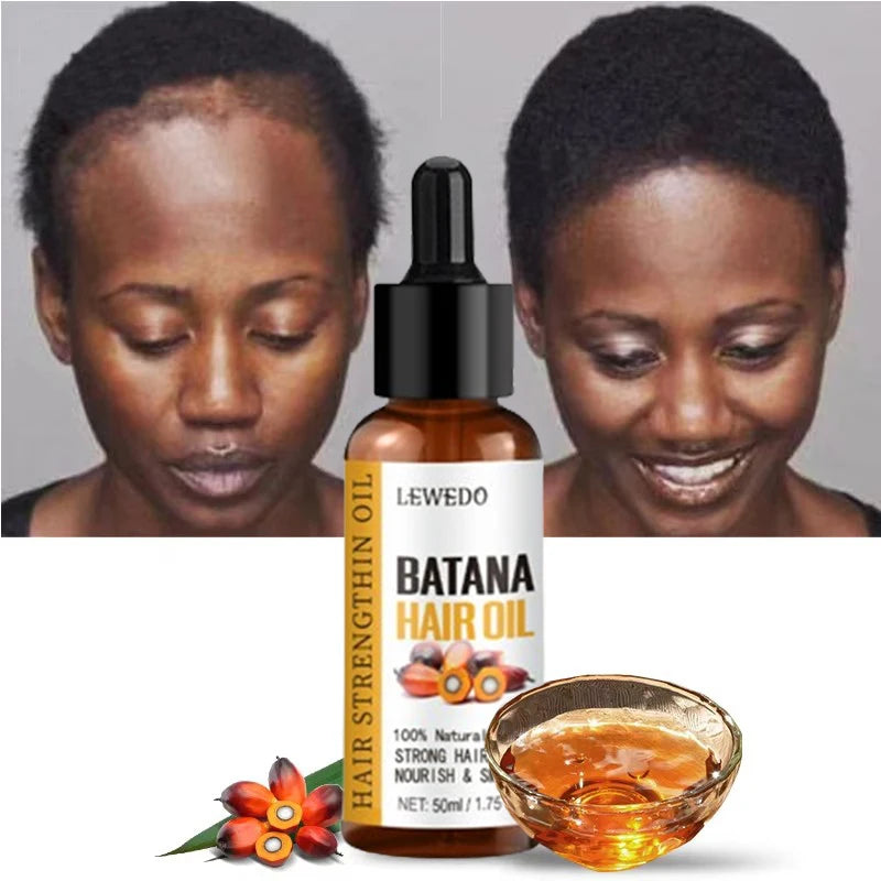 🌴 SabbaVie™ Pure Batana Hair Growth Oil — Nourish, Strengthen & Restore