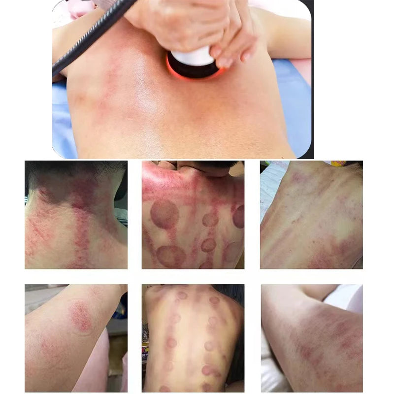 🔭 2️⃣ SabbaVie™ 4-in-1 Ultrasonic Cavitation Body Slimming Machine