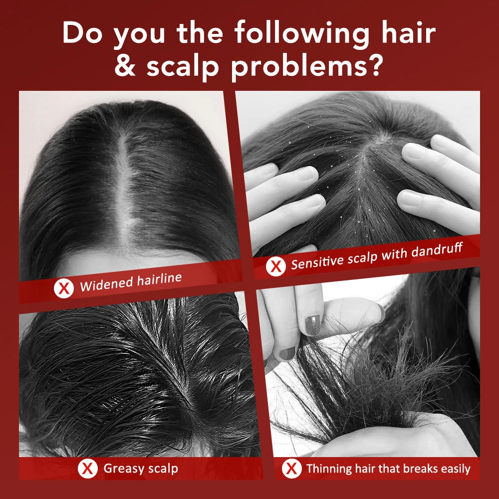 💆‍♀️ 3️⃣ SabbaVie™ Electric Hair & Scalp Massage Comb — Vibrating Infrared Comb