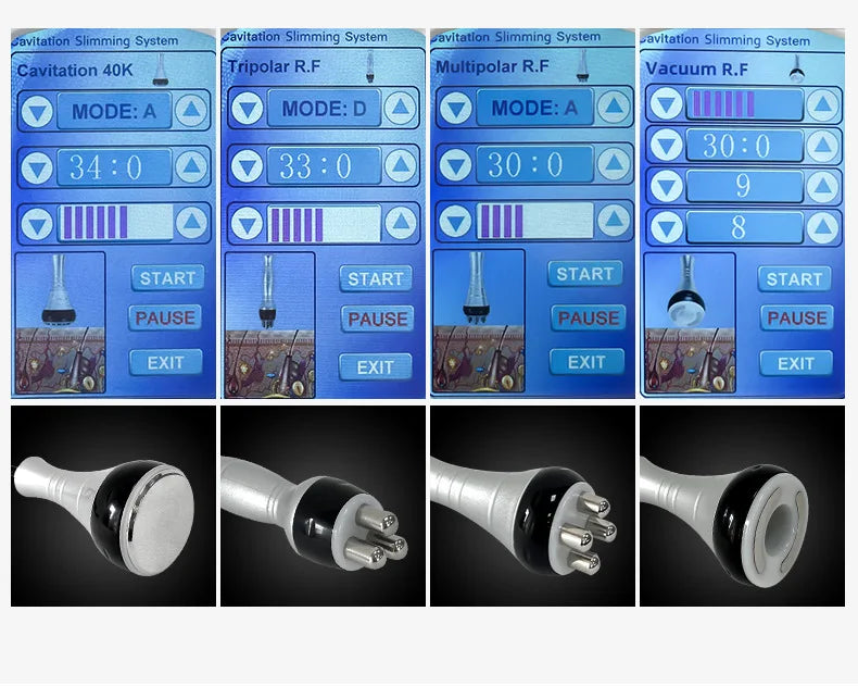 🔭 2️⃣ SabbaVie™ 4-in-1 Ultrasonic Cavitation Body Slimming Machine